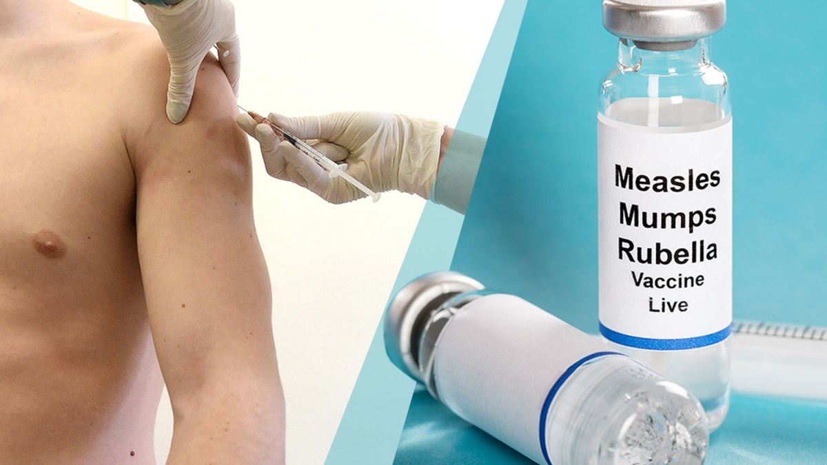 Understanding Measles and Its Impact on Public Health